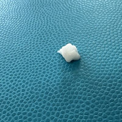 Zaawansowany efekt wypełniania linii marionetkowych wstrzyknięciem hydroksyapatytu wapnia