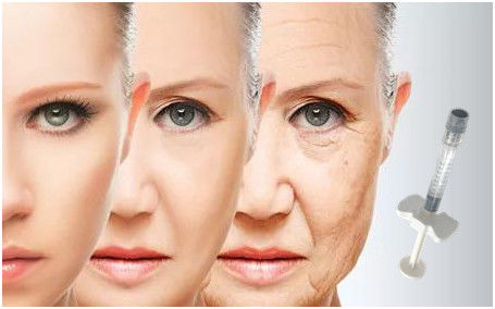 Wypełniacz do twarzy z kwasem hialuronowym 24 mg / ml do depresji policzkowych kurzych łapek