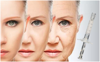 Przeciwzmarszczkowy lifting twarzy PCL Skin Booster 2 ml polikaprolaktonowego kwasu hialuronowego