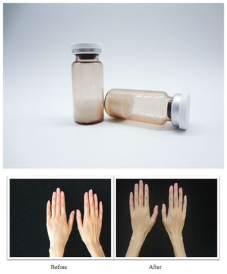 Sterylne wypełniacze skóry twarzy PLLA kwas hialuronowy żel do wstrzykiwań przeznaczony do płynnego naprawiania zmarszczek i przywracania objętości twarzy