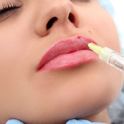 Żelowe wypełniacze do ust do wstrzykiwań 24 mg / ml Naturalny kwas hialuronowy