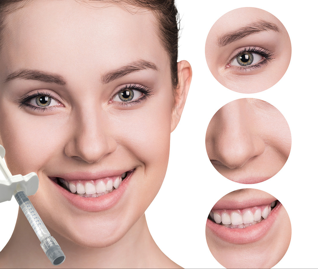 1ml Dermal Lip Fillers usieciowany hialuronian sodu do plastyki nosa